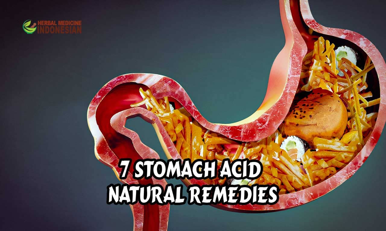 7 Stomach Acid Natural Remedies