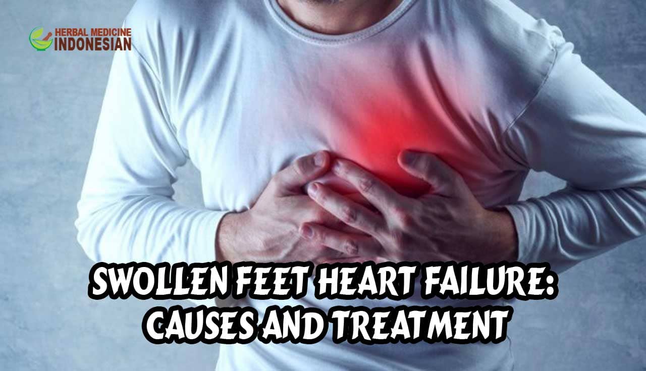 Swollen Feet Heart Failure: Causes and Treatment