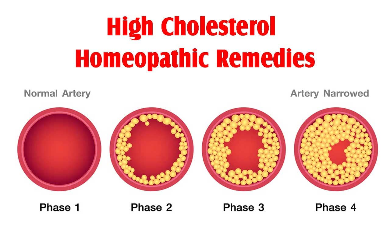 High Cholesterol Homeopathic Remedies