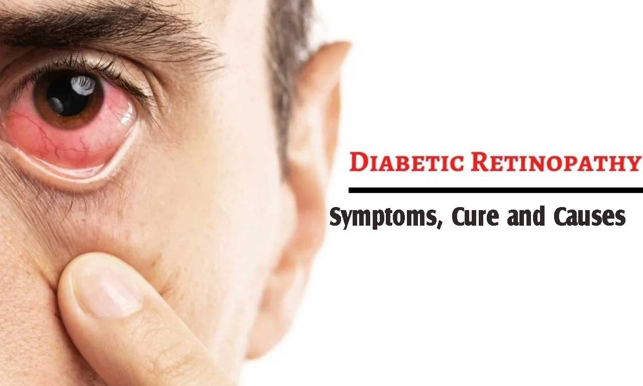 Diabetes Retinopathy: Symptoms, Cure and Causes